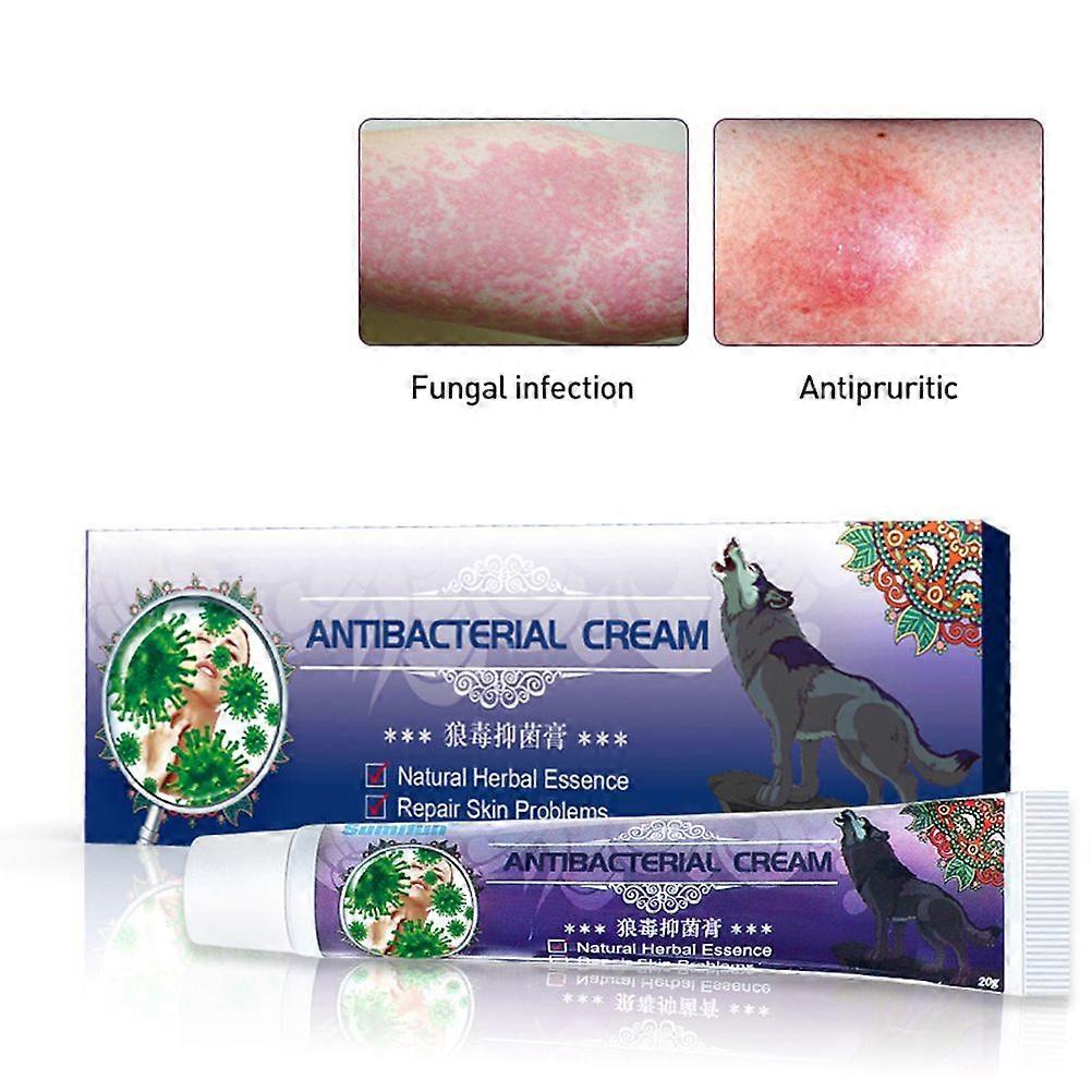 Antibacterial Ointment Efficient Itchy Skin Arthritis External Cream