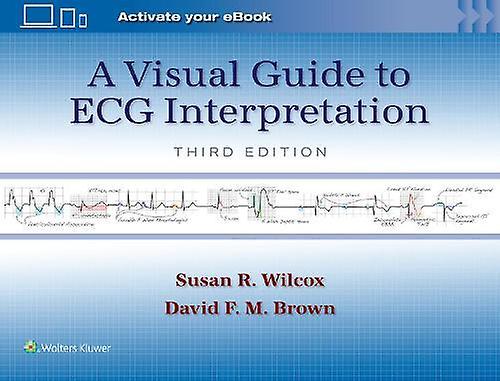 A Visual Guide To Ecg Interpretation Print book With Multimedia by Susan Renee Wilcox Paperback Book