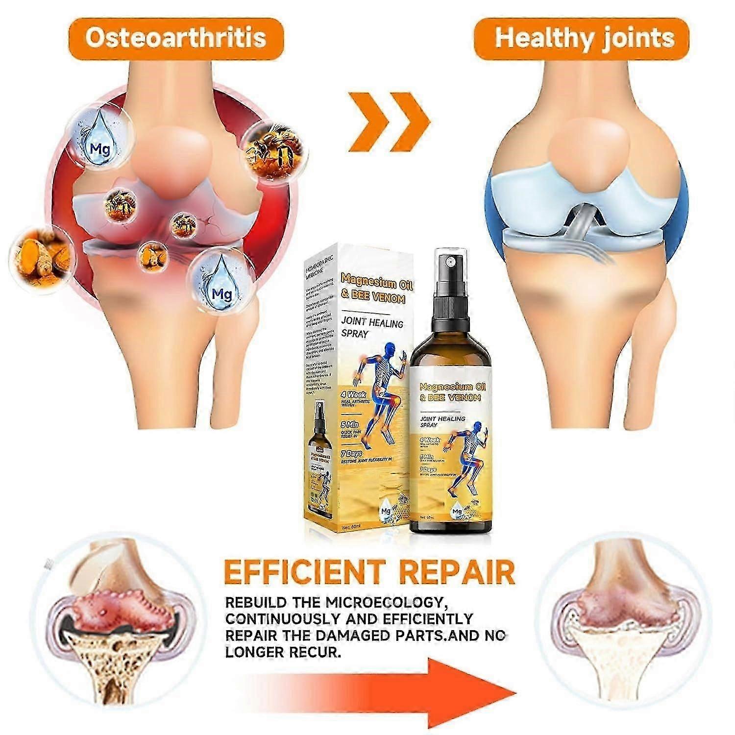 Bee Venom Spray, Bee Venom Joint & Bone Care Spray, Magnesium Oil Bee Venom Joint Relief Spray, Joint Massage Spray For Muscle Joint Discomfort