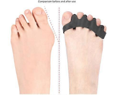 4 Pcs Toe Separators For Overlapping Toes And Restore Crooked Toes
