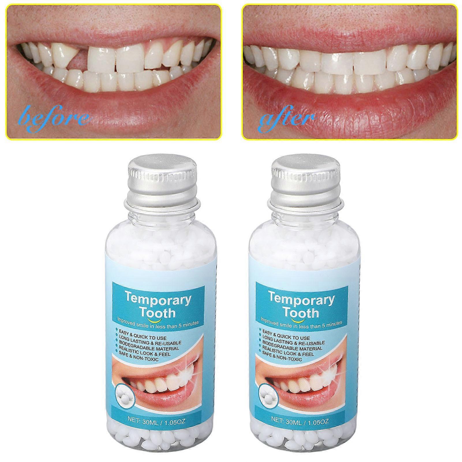 2pcs Tooth Repair Glue Temporary Moldable Teeth Filling Replacement for Fixing Missing Tooth 