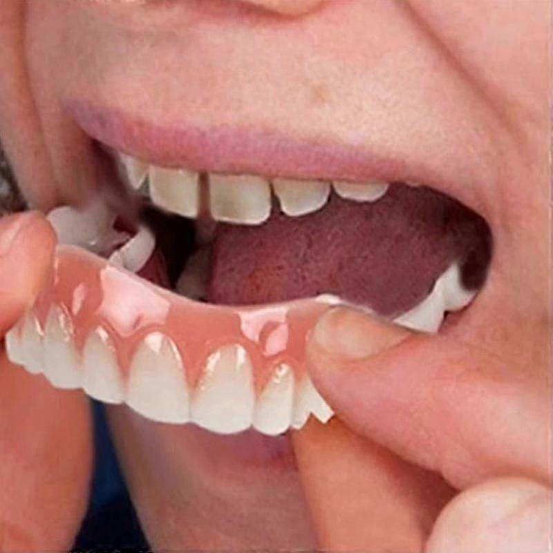 Extra Thin Silicone Tooth Veneers, Soft Adhesive, Hide Stained Teeth, Upper Lower Set