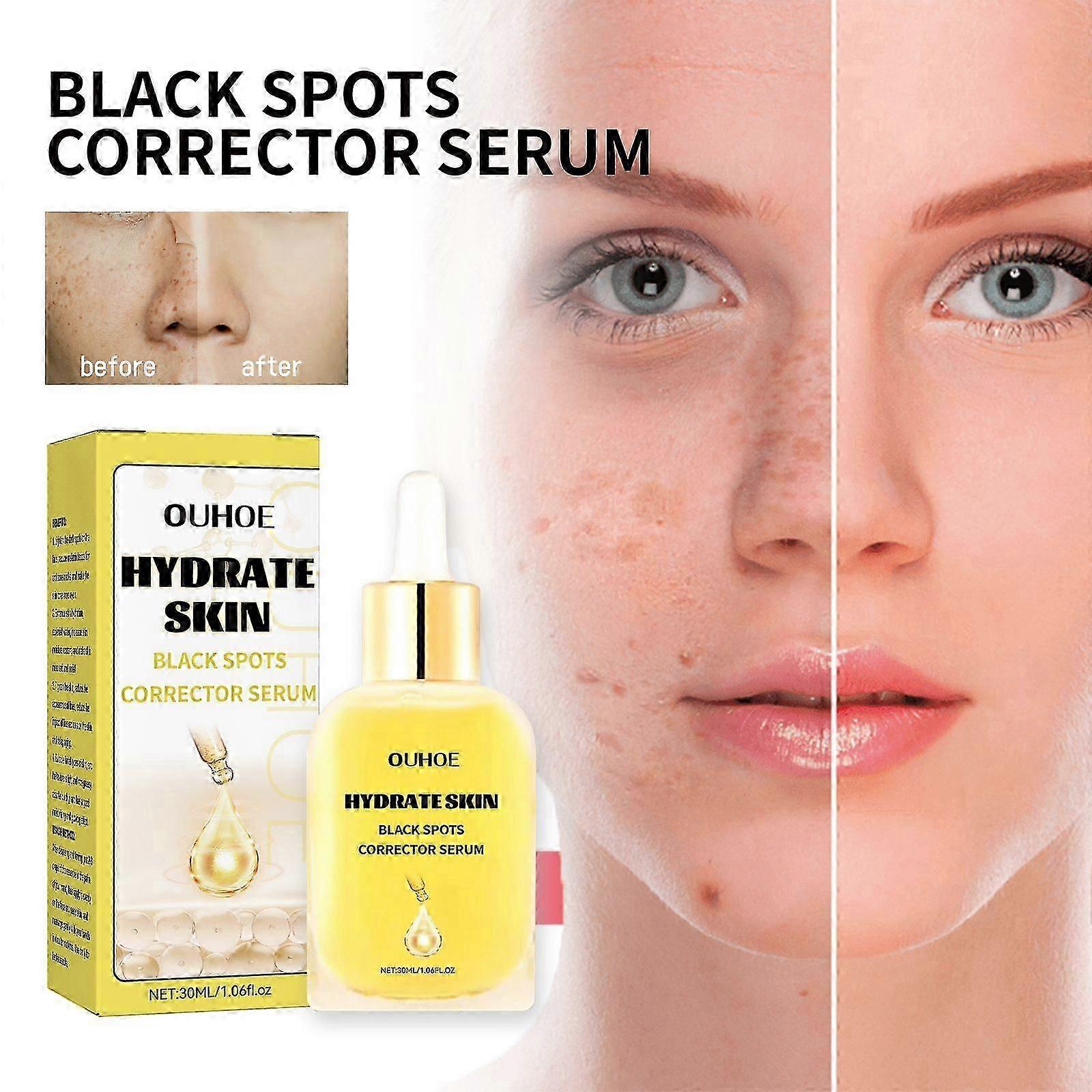 Dark Spot Correction Serum  Brightening Essence for Reducing Dark Spots, Fine Lines  Wrinkles, 30ml