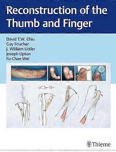 Reconstruction Of The Thumb And Finger Paperback Book