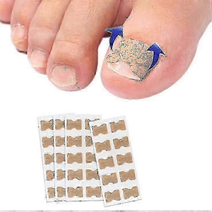 25-26 100pcs Toenail Correction Patch Glue Free Pedicure Tools Corrector Toe Nail Ingrown Patch