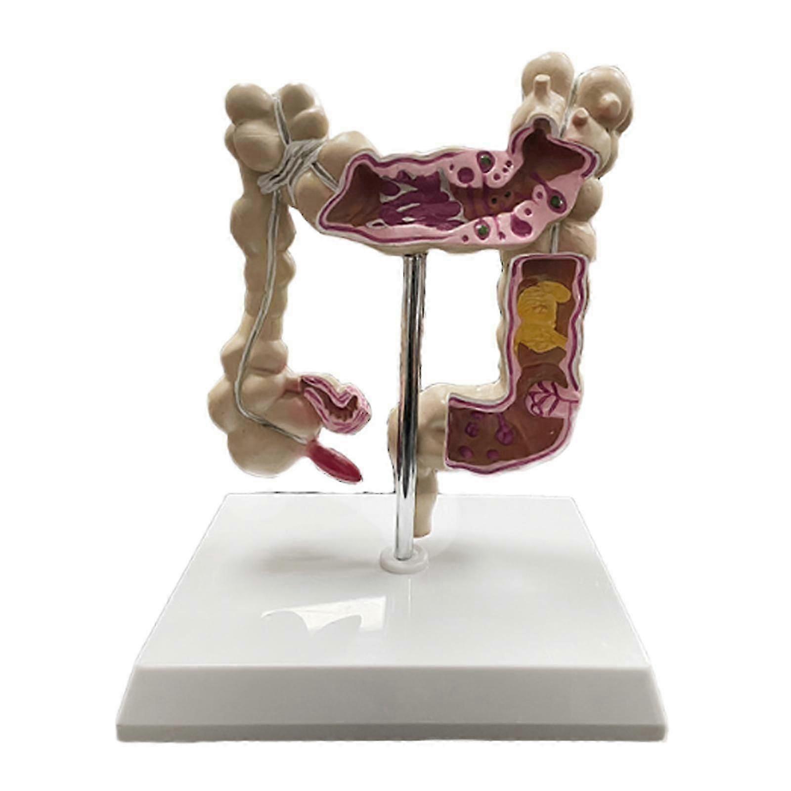 Human Large Intestine Model Digestive System Model for Lab Training Studying
