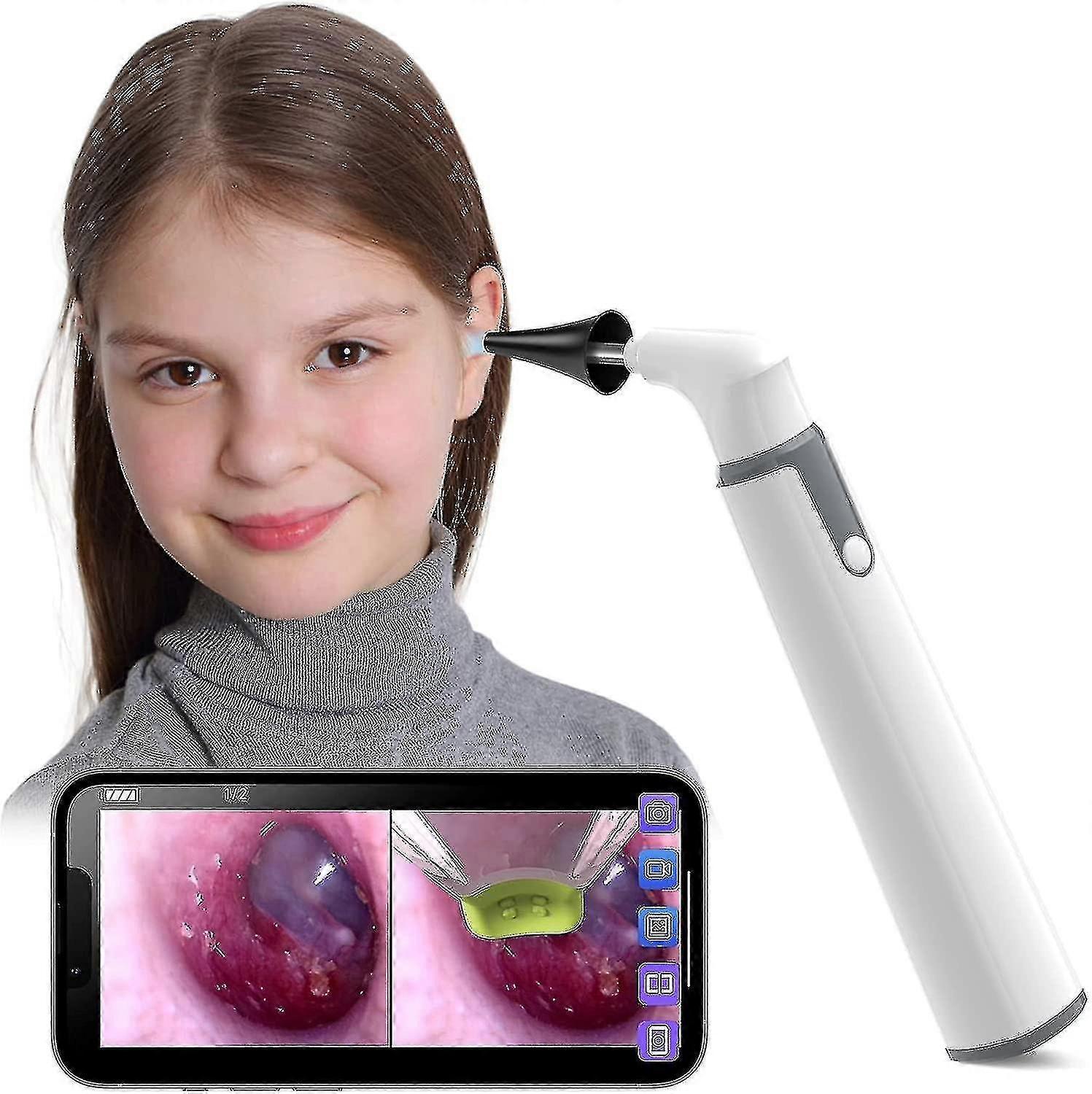 Wireless Otoscope Intra-Ear Camera with Dual View, 6 LED Lights