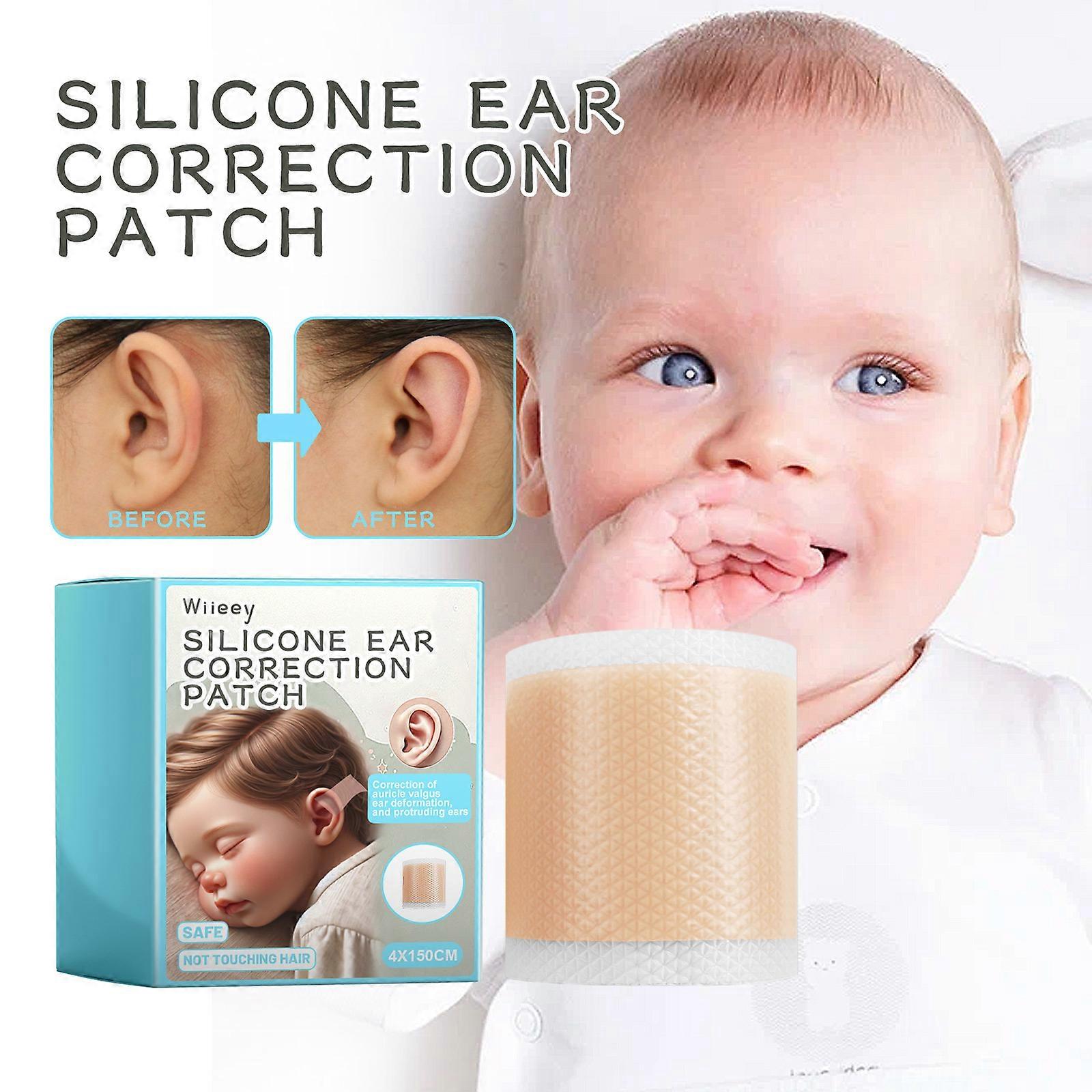 Baby Soft Breathable Silicone Ear Correctors Tape, Baby Auricle Valgus Correction Patch For Child Infant Baby Ear Correction