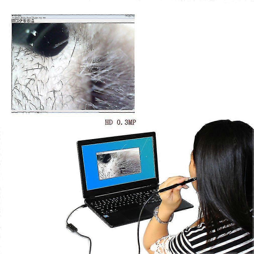 Usb Ear Cleaning Endoscope Visual Earbuds With Mini Camera Ear Cleaning Tool