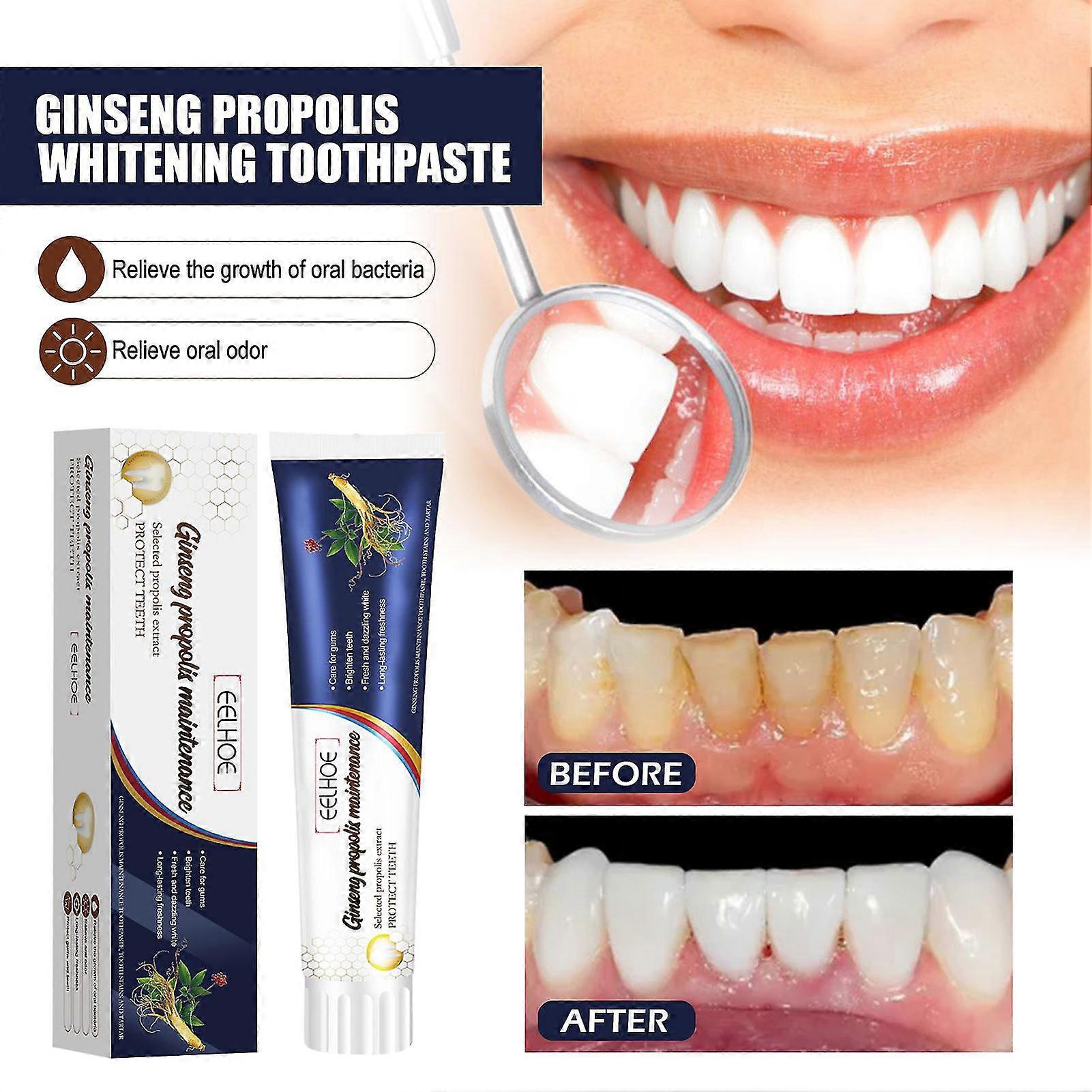 Ginseng Propolis Whitening Toothpaste Remove Stains Color Correction Toothpaste For Sensitive Teeth & Gum Problems