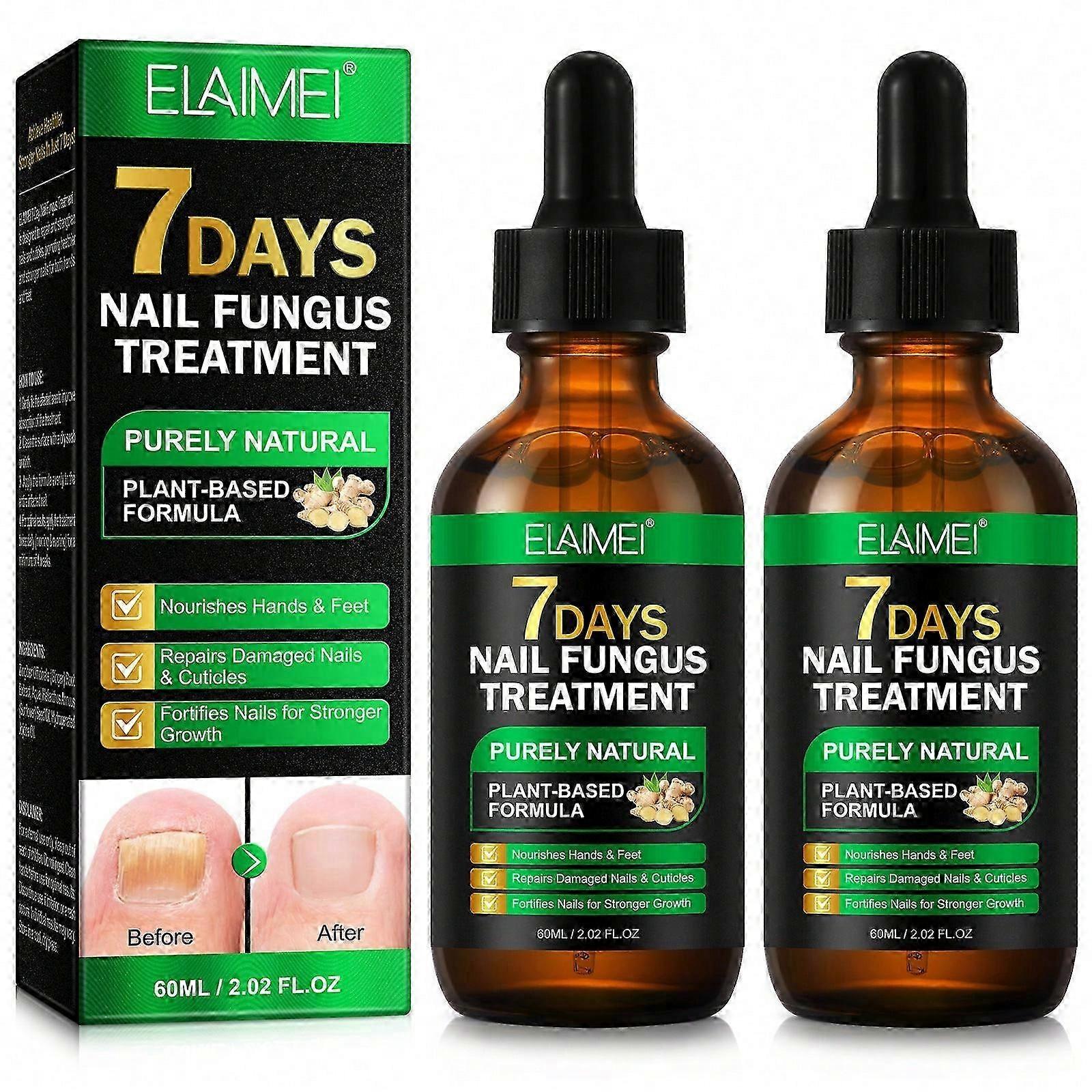 Para control remoto de garaje universal NICE de 433,92 MHz, 2 canales, código variable A