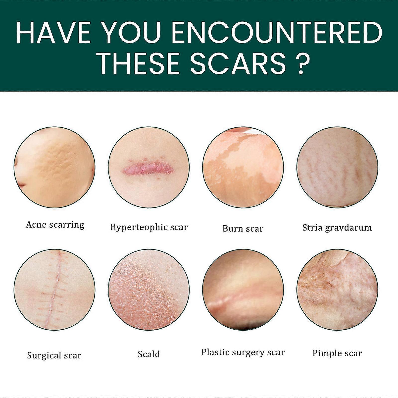 2box tatueringar täcker upp klistermärken hud ärr concealer patch