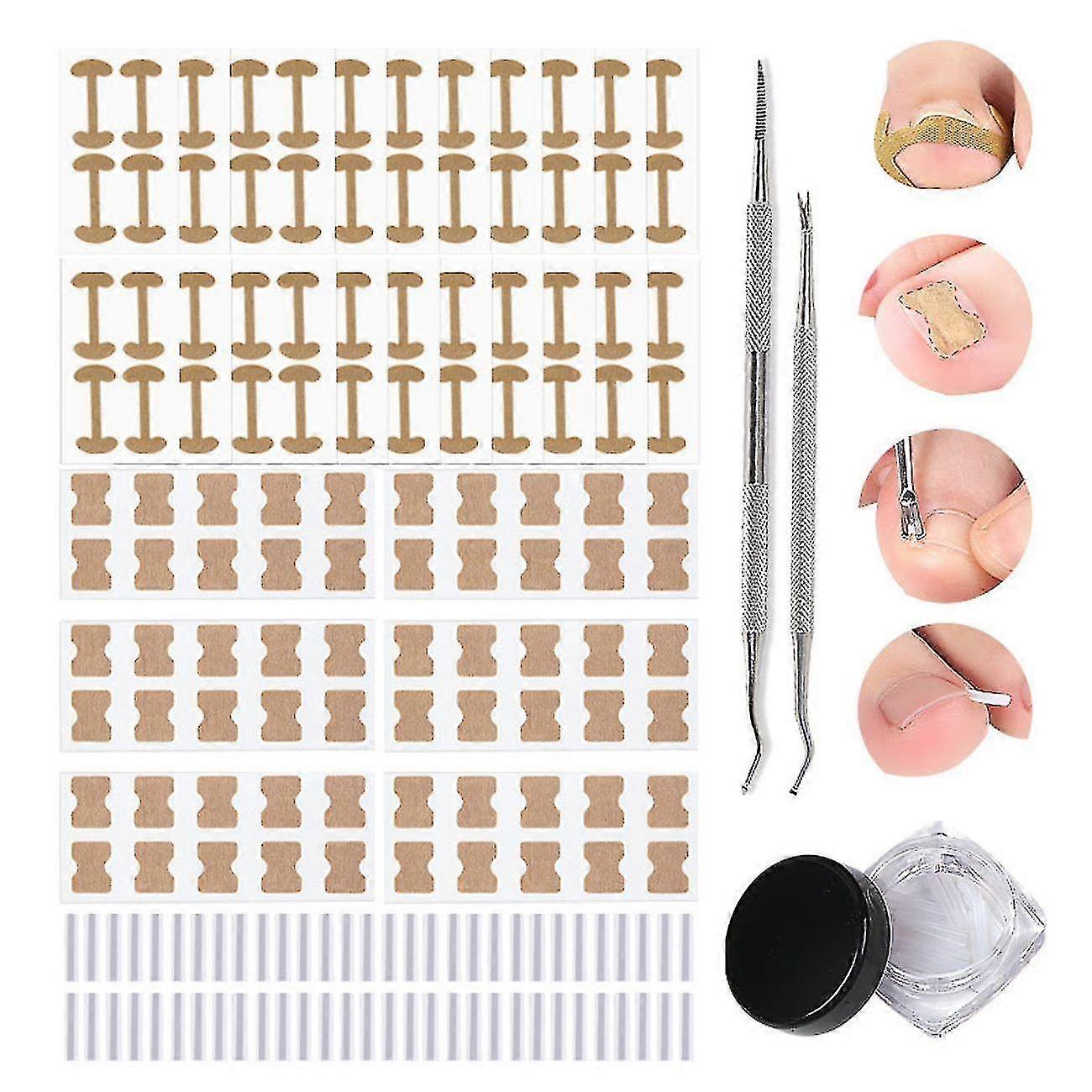 1set Nail Correction Stickers Ingrown Toe Nail Correction Clean Tool