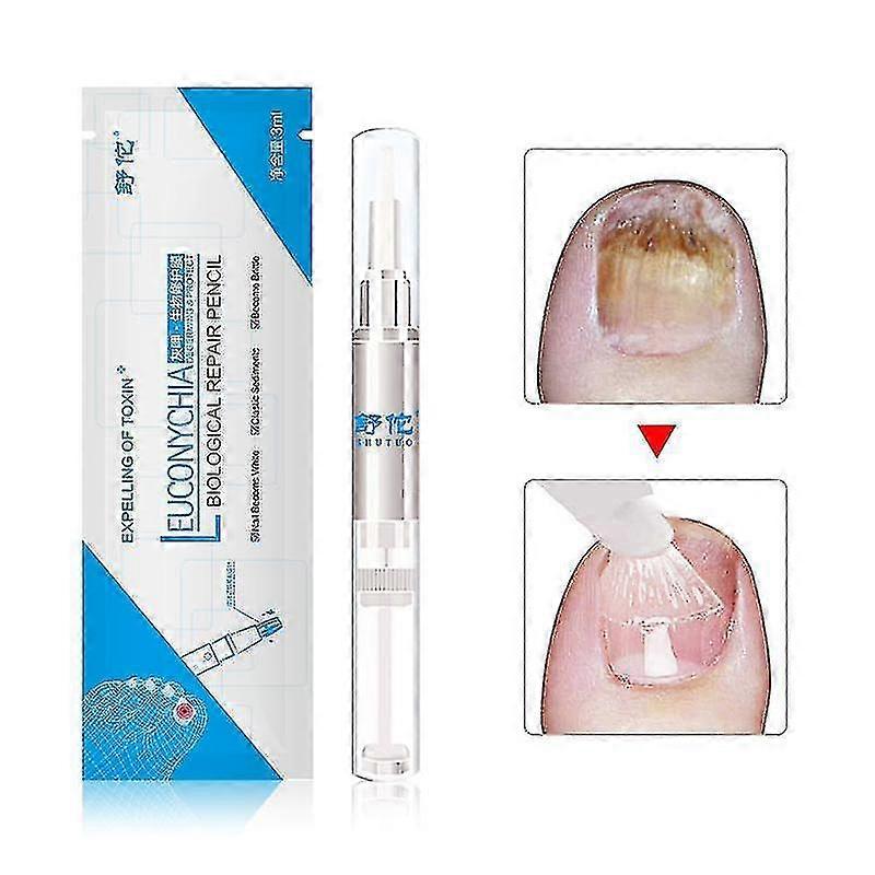 3ml Pilzbehandlung Nagelölstift Anti-Pilz-Nagelhautentferner