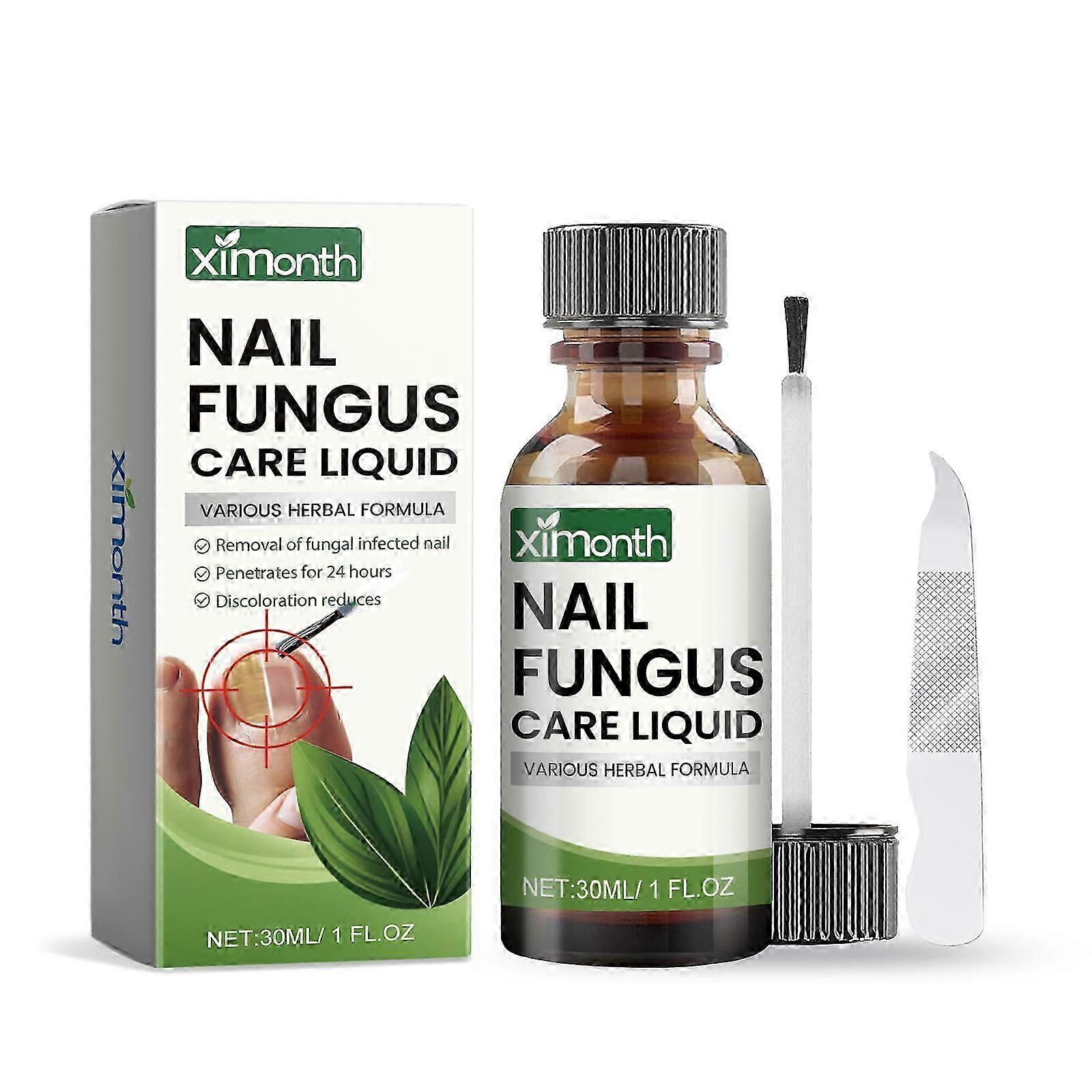 Ximonth Zestaw do naprawy paznokci dłoni, stóp i palców u nóg Pielęgnacja paznokci stóp Whitenail Bright Nail Soft Nail Embedding Care Liquid