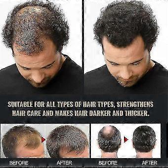 3 pezzi Shampoo attivatore di radice spartana, Shampoo per la perdita di capelli sparta, shampoo Root Activator-TF