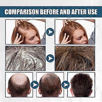 OUHOE spray de essência de cabelo denso anti-gota sólida cabelo reparação cabelo seco e frizz hidratante thic