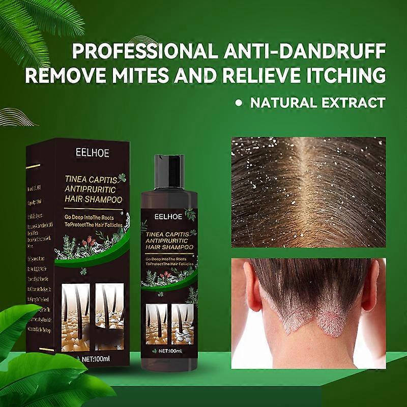 Hair Shampoo for Tinea Capitis Antipuritic Professional Antidandruff Remove Mites and Relieve Itching Shampoo