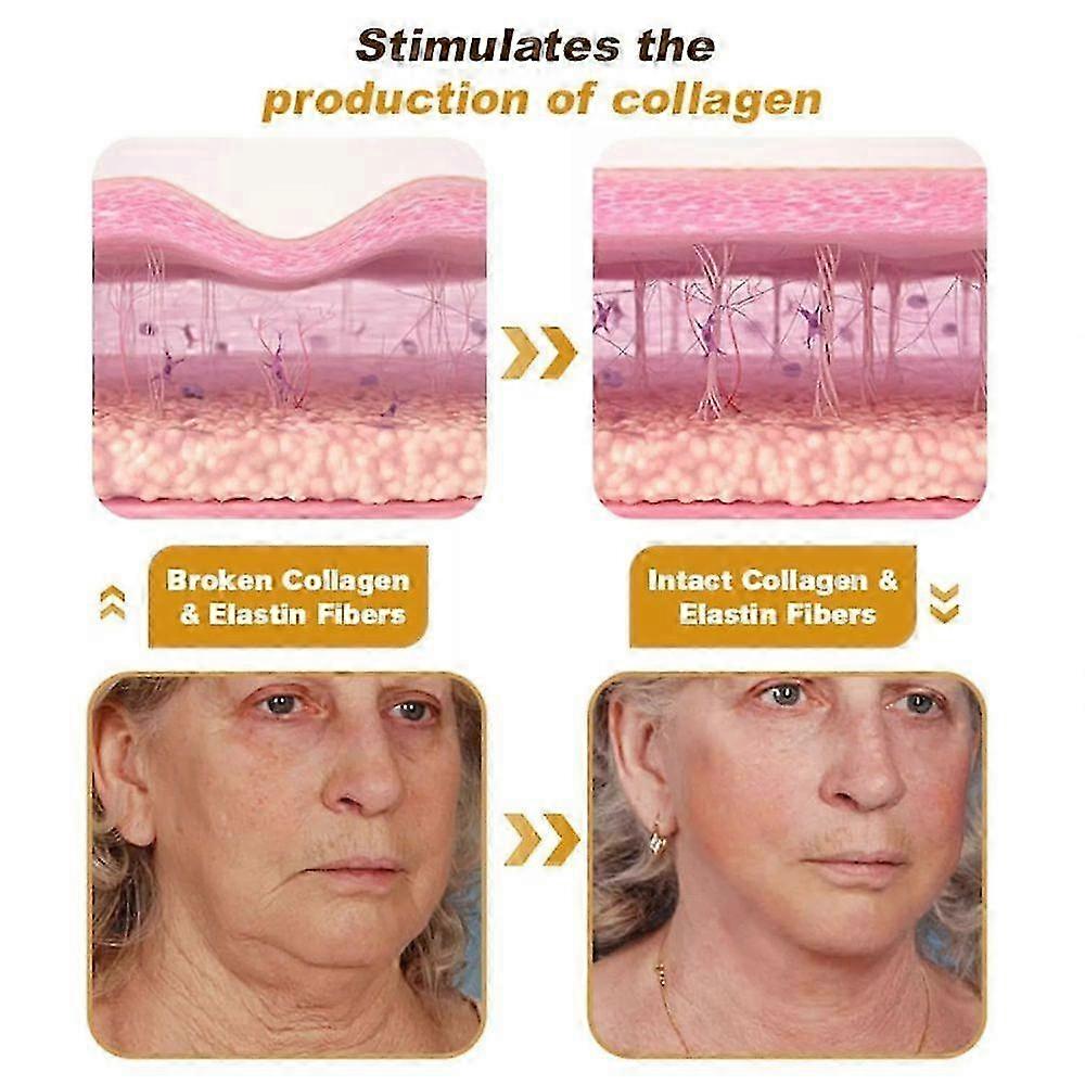 2/3/5PCS 蜂毒しわ除去アンチエイジングクリーム-JCに適しています