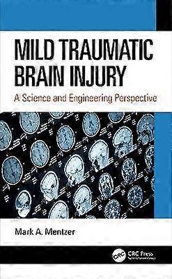 Mild Traumatic Brain Injury
