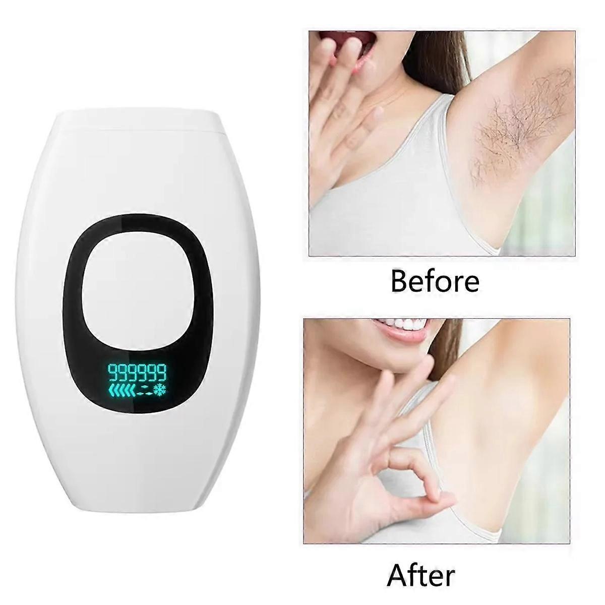 IPL Hair Removal Device 999,999 Flashes EU-PLUG A