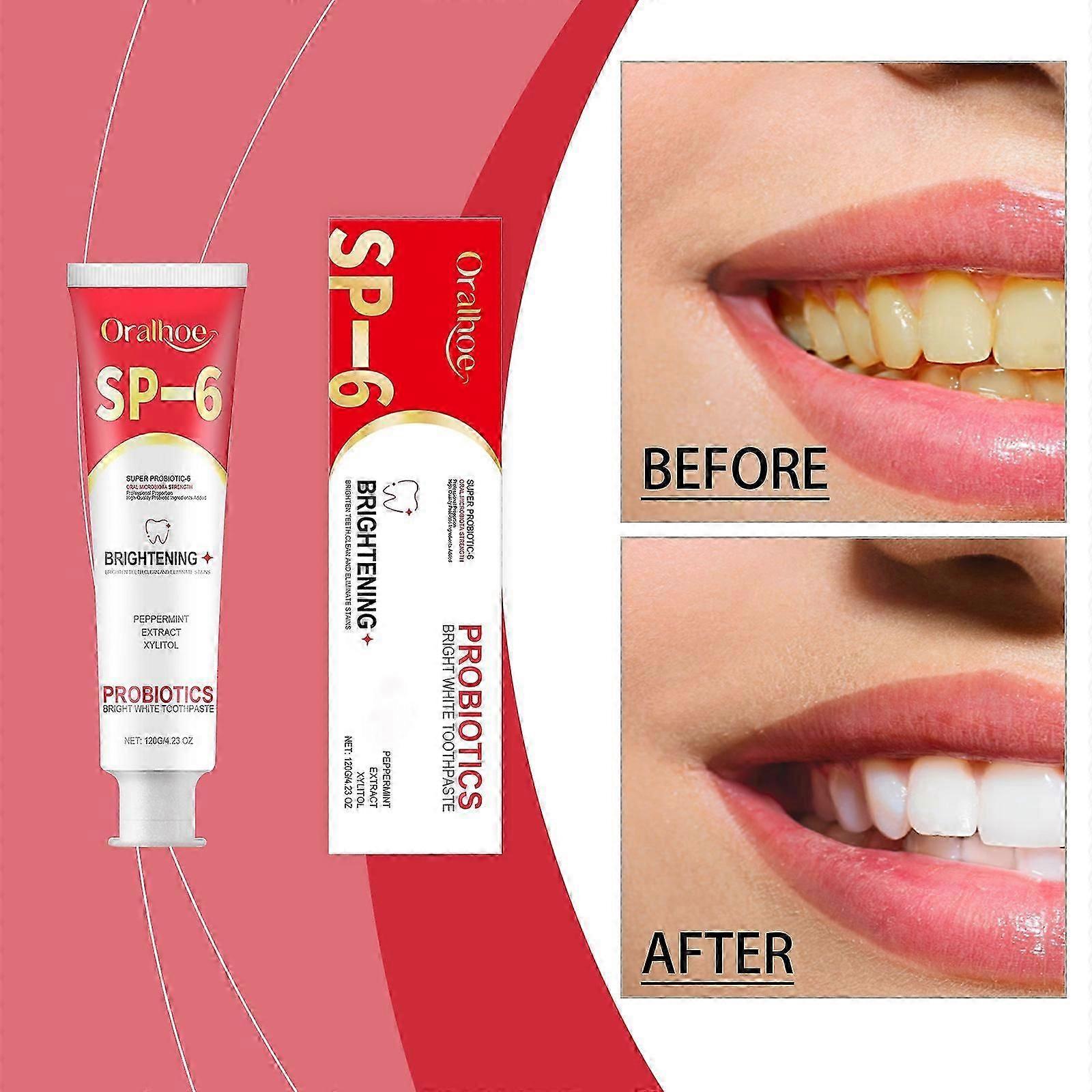 Sp-6 Toothpaste, Sp 6 Toothpaste, Ultra Whitening Toothpaste Sp-6, Sp-6 Ultra Whitening Probiotic Brightening Toothpaste, Fresh Breath