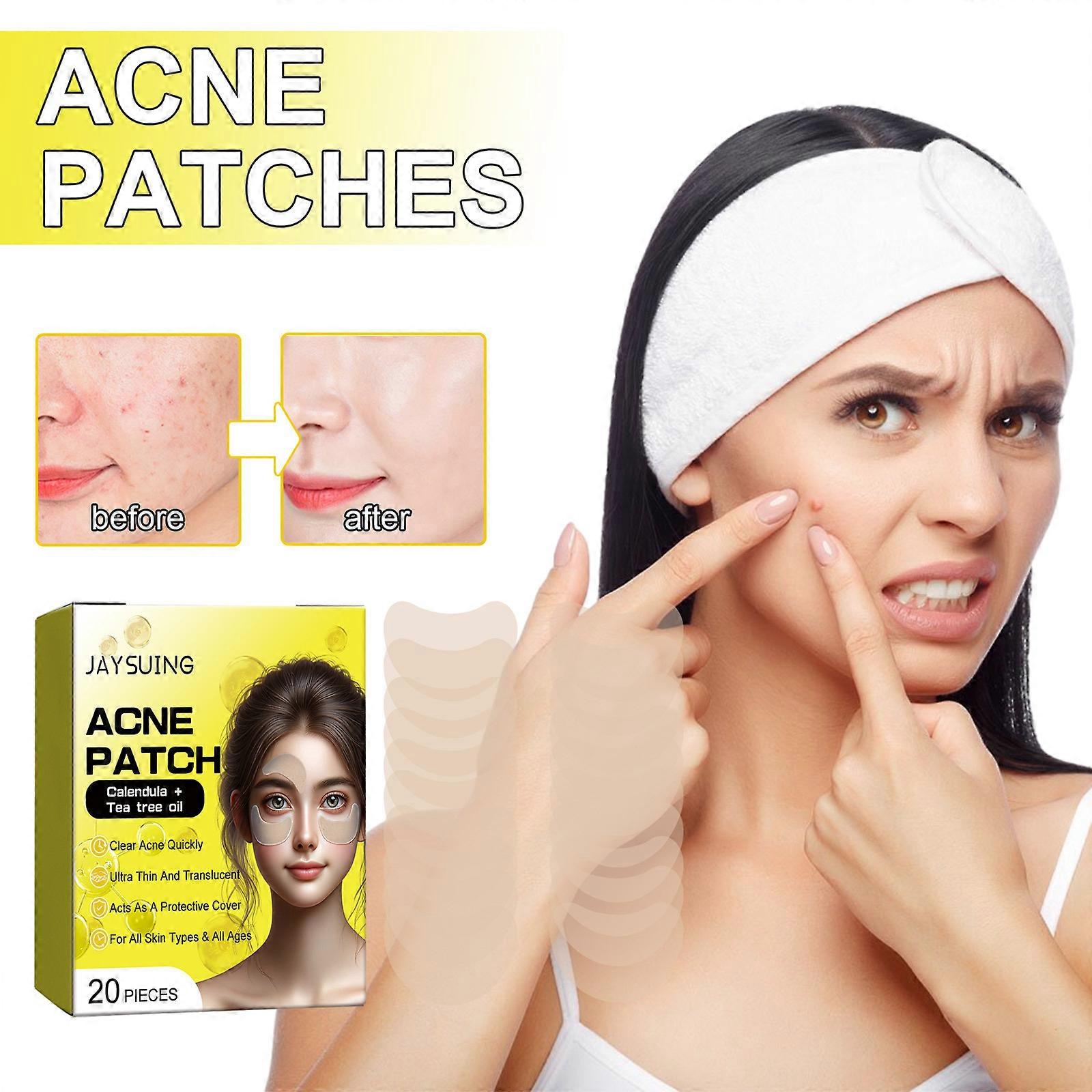 Hydrocolloid Acne Patch Pimple Patches Acne Patches Tea Tree Oil and Salicylic Acid Pimple Patch for Face Cheek, Forehead, and Chin