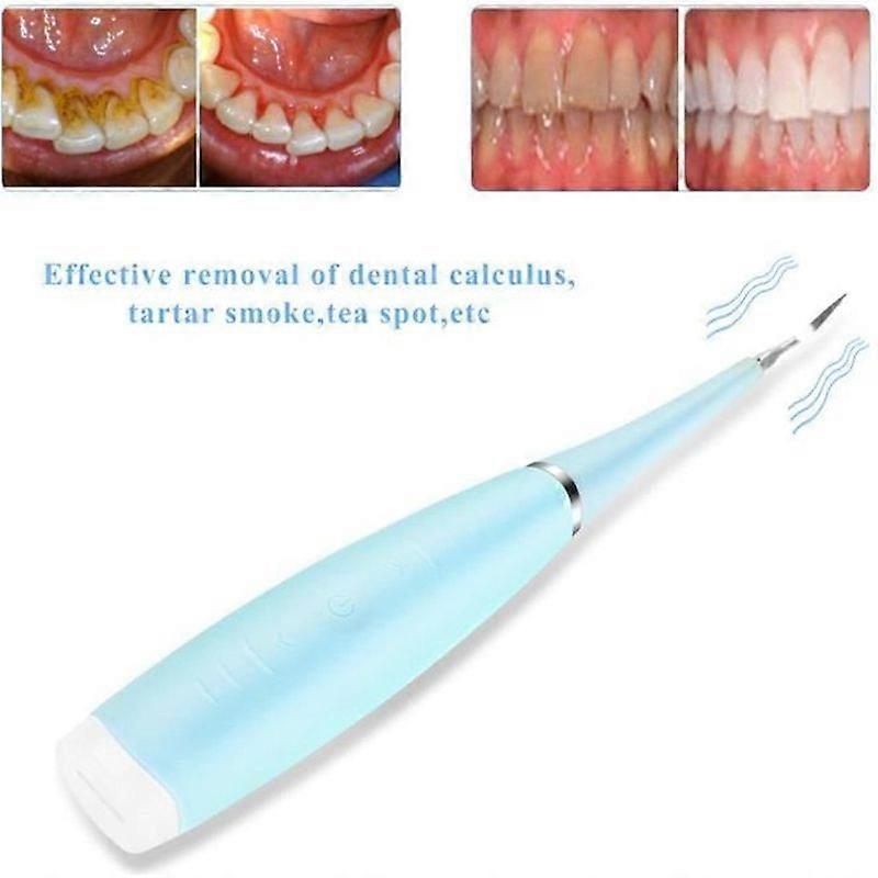 Dental Scaler - Not Specified - Blue Model - 5 Adjustable Modes - USB Charging - Waterproof