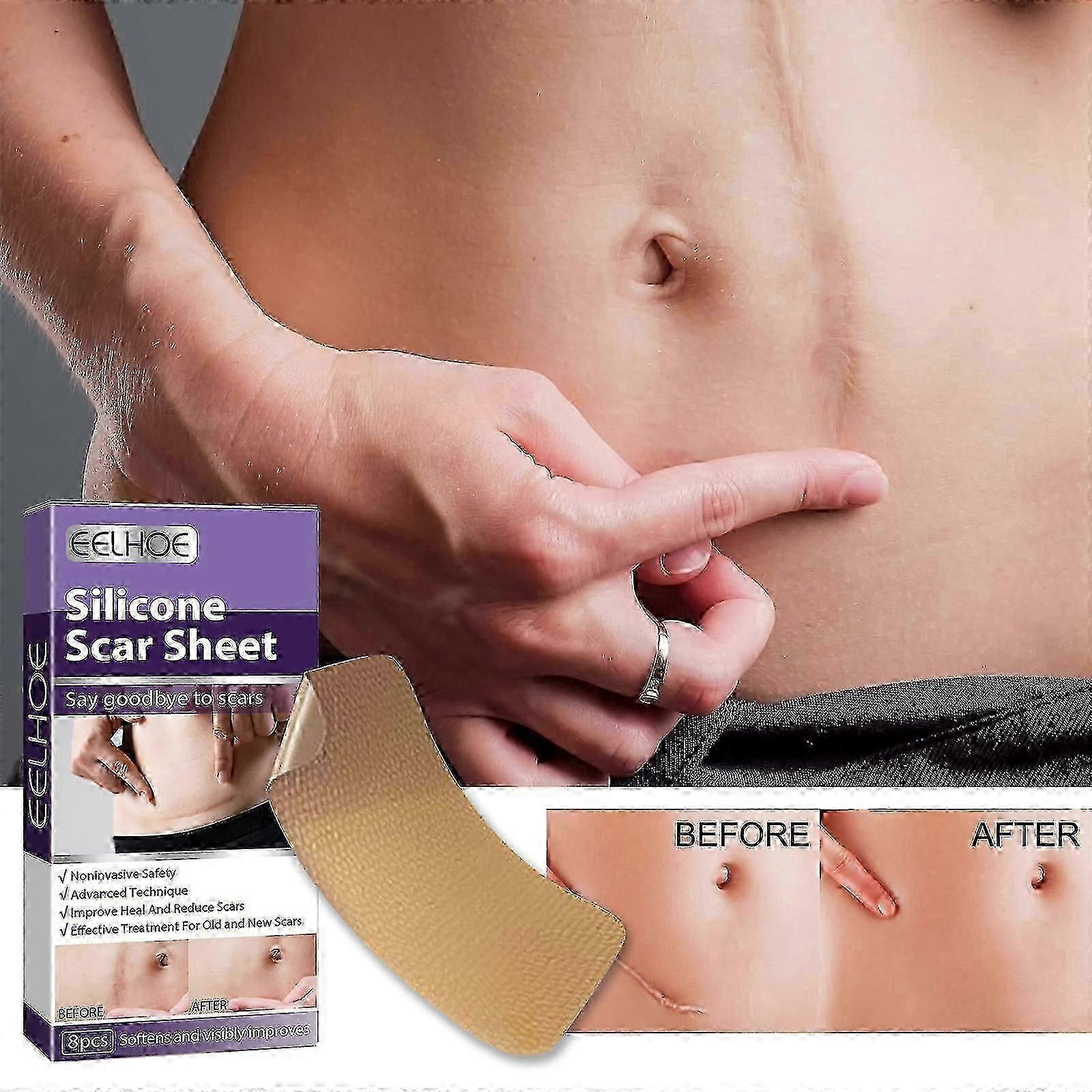 Silicone Patch, Removal, Invisible Silicone Patch, Covering Tape, Removal Patch