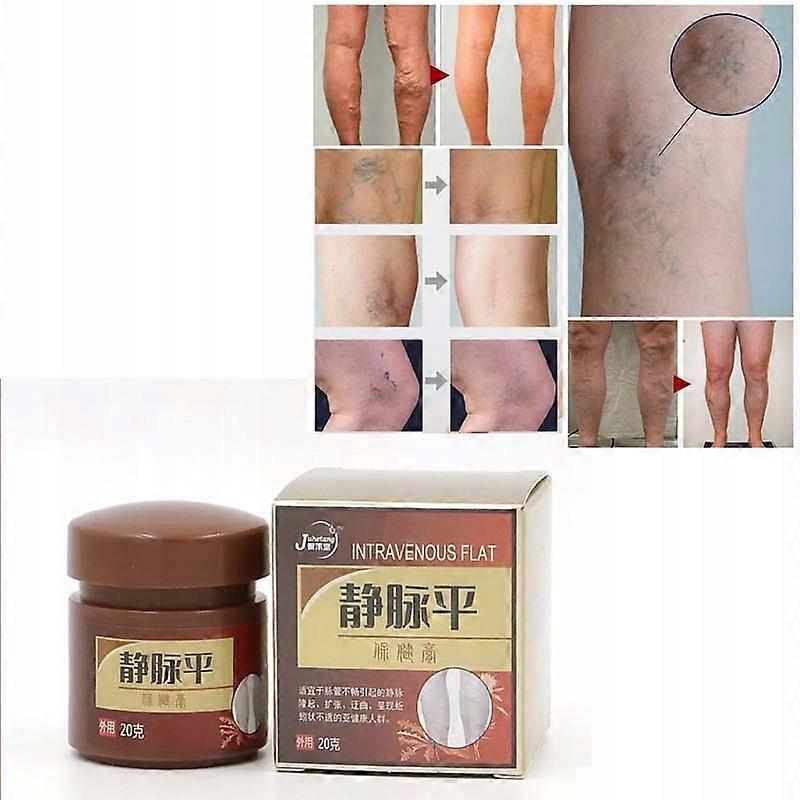 Åderbråck, spindlar, svullnader, svullna tunga ben