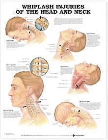 Whiplash Injuries Of The Head And Neck Anatomical Chart Book