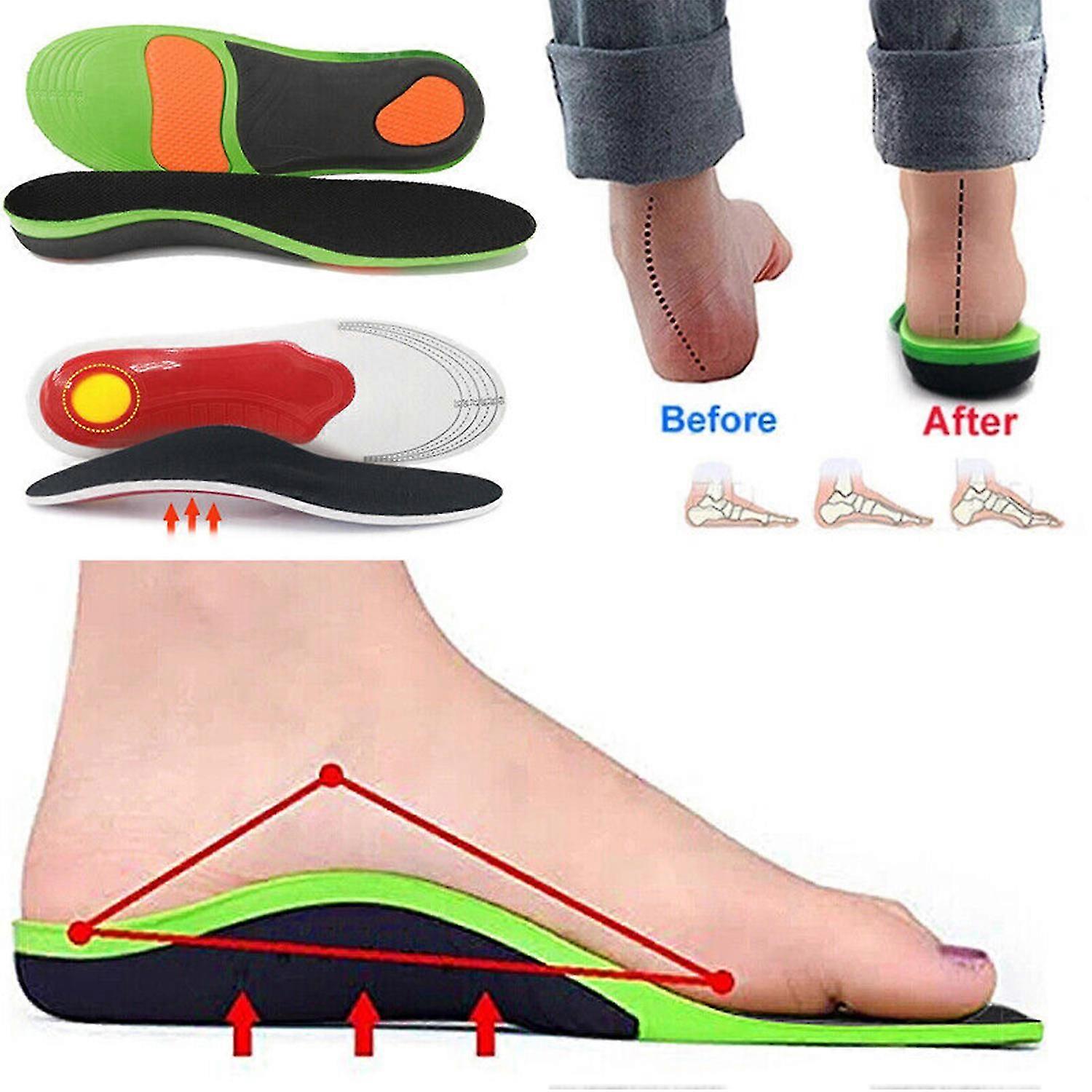 Orthopedic insoles Insert Arch Support Flatfoot Heel Pain Plantar Fasciitis 2025