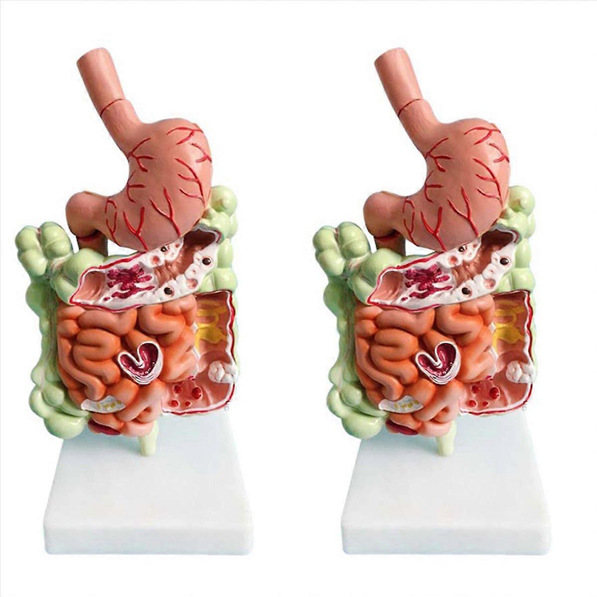 Human Digestive System Model Stomach Anatomy Large Intestine Cecum