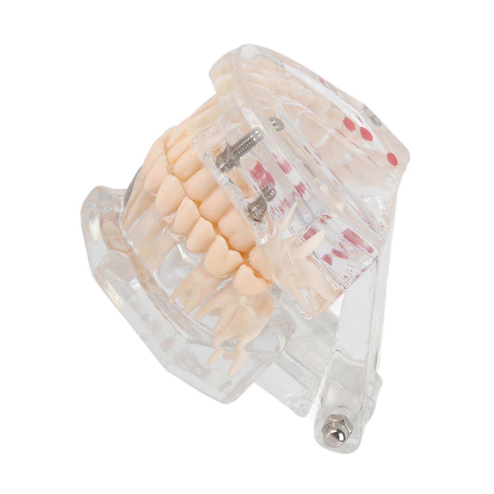 New Dental Teaching Study Standard Tooth Model Demonstration Disease Educational