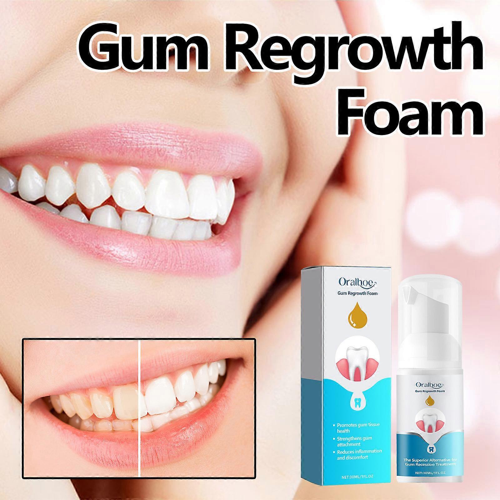 Gums Regrowth Foam 30ml