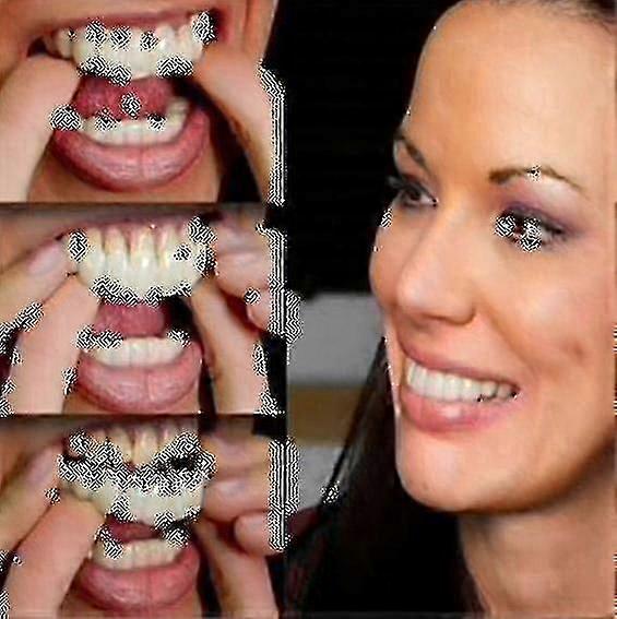 ペア上部入れ歯インスタントスマイルコンフォートフィットフレックス審美歯義歯歯トップ審美Veneer_k05