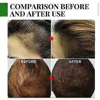Rosmarinöl regt das Haarwachstum an. Rosmarinöl für Haarwachstum und Hautpflege (26 Stück).
