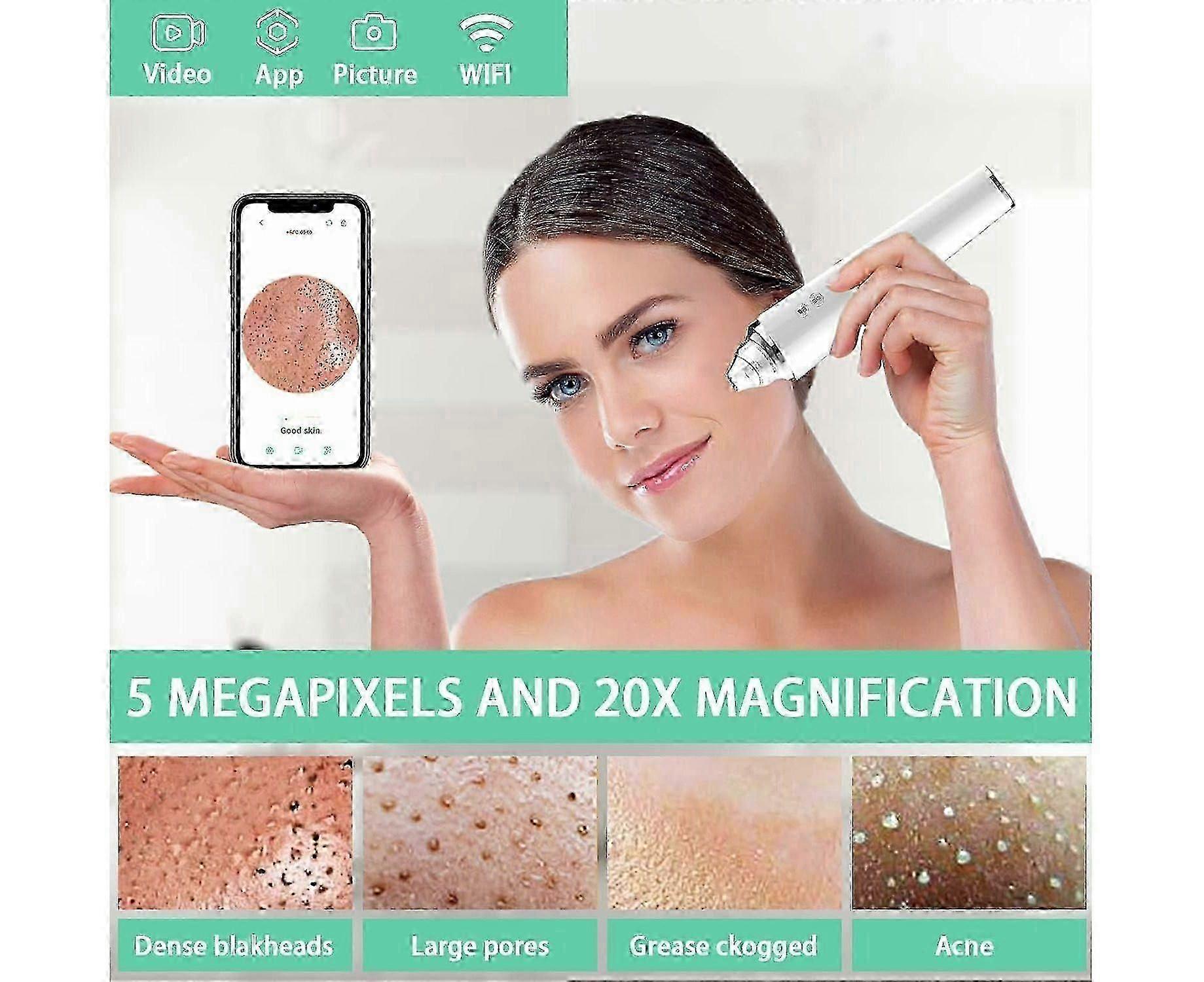 High-Definition Blackhead Remover Vacuum with Camera - Wireless Pore Cleaner for