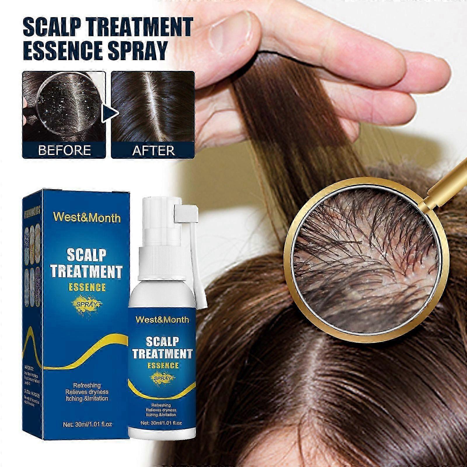 Scalp Treatment Spray