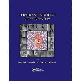 Contrast-induced Nephropathy In Interventional Cardiovascular Medicine - Taylor & Francis Ltd