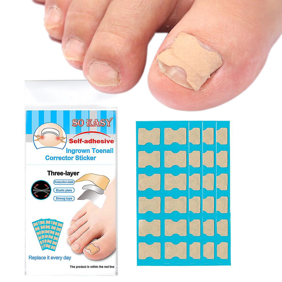 36pcs Nail Correction Stickers Toenail Patch Ingrown Paronychia Pedicure Tool Toe Inlay Corrector Elastic Nail Patch