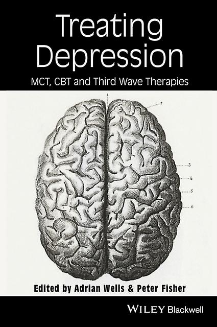 Treating Depression Paperback Book