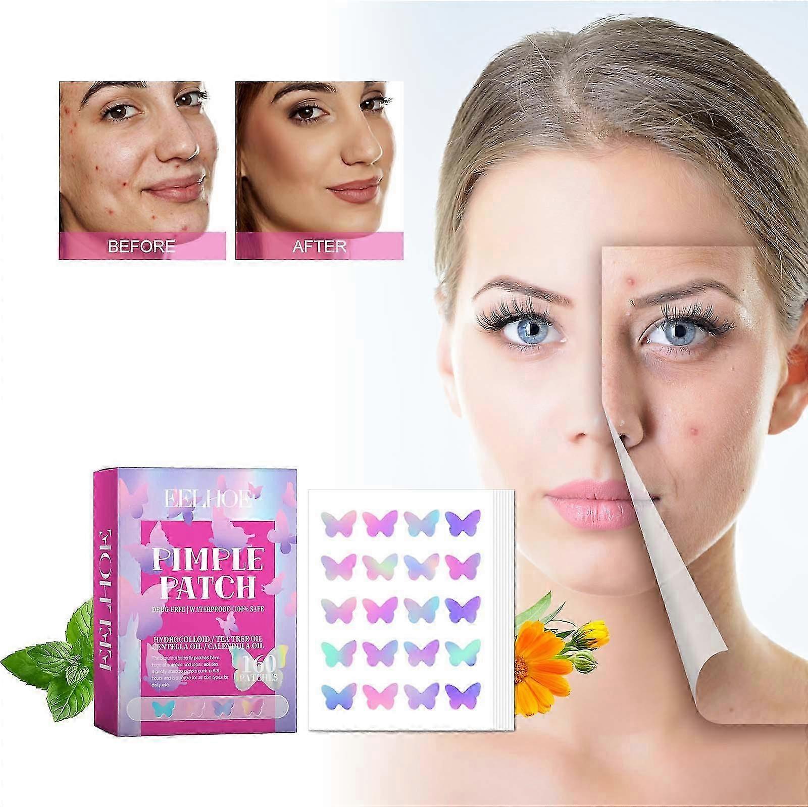 Acne Pimple Patches for Face, Hydrocolloid Acne Patches with Tea Tree Oil Extract, Cute Colorful Butterfly Shape Spot Stickers