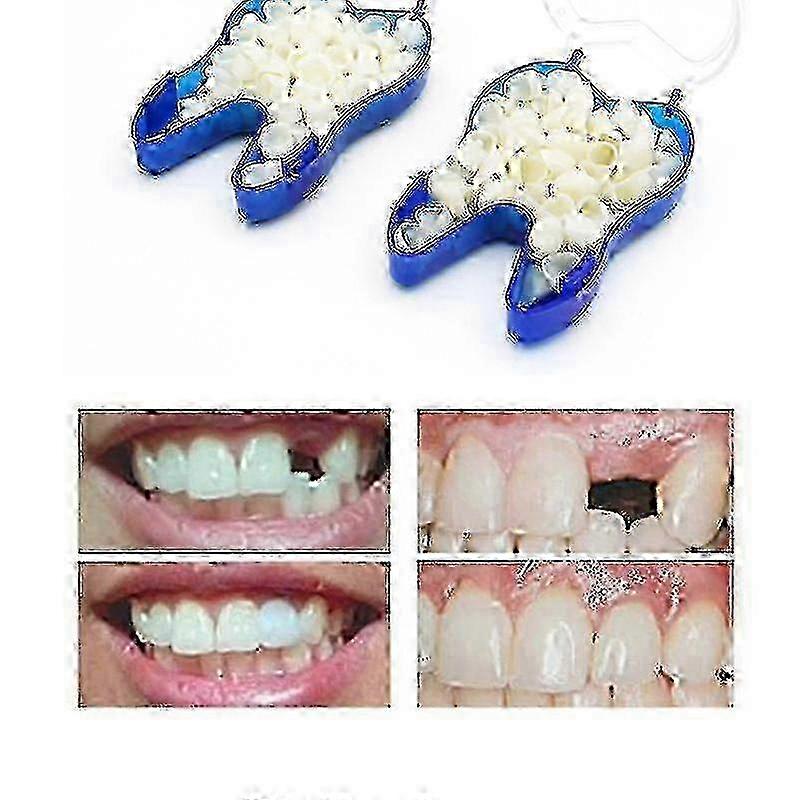 Temporary Denture Occlude Upper Dentures Veneer Dentures Missing Teeth Teeth