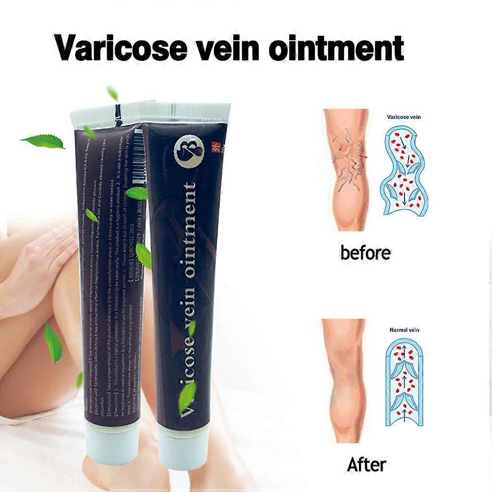 Spataderen Crème Effectieve Vasculitis Flebitis Spataderen Spataderen Gezondheidszorg Zalf