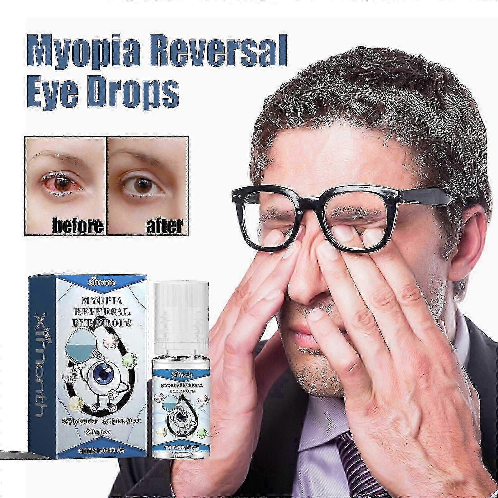 Cataract Removal Eye Drop Improve Blurred Vision Restore Eyesight Relieve Eyeball Infection Dry Itching Red Eyes Treatment Drop