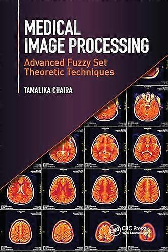 Medical Image Processing Advanced Fuzzy Set Theoretic Techniques