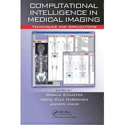 Computational Intelligence in Medical Imaging: Techniques and Applications