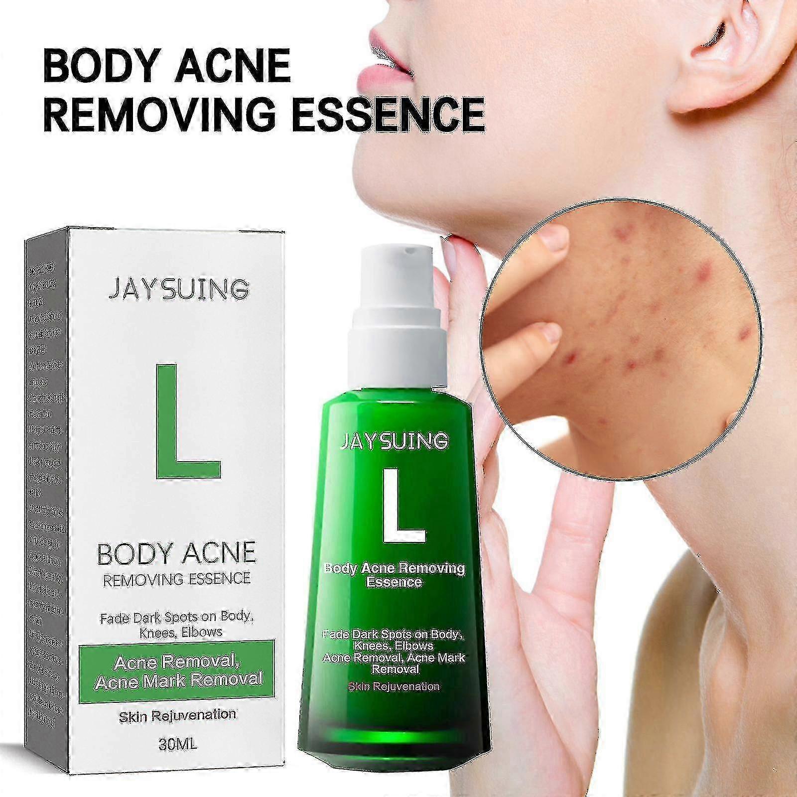 ジェイスイング アンチニキビ ホワイトニング エッセンス ニキビ跡や跡を薄くする 保湿美白 スキンケア エッセンス | |