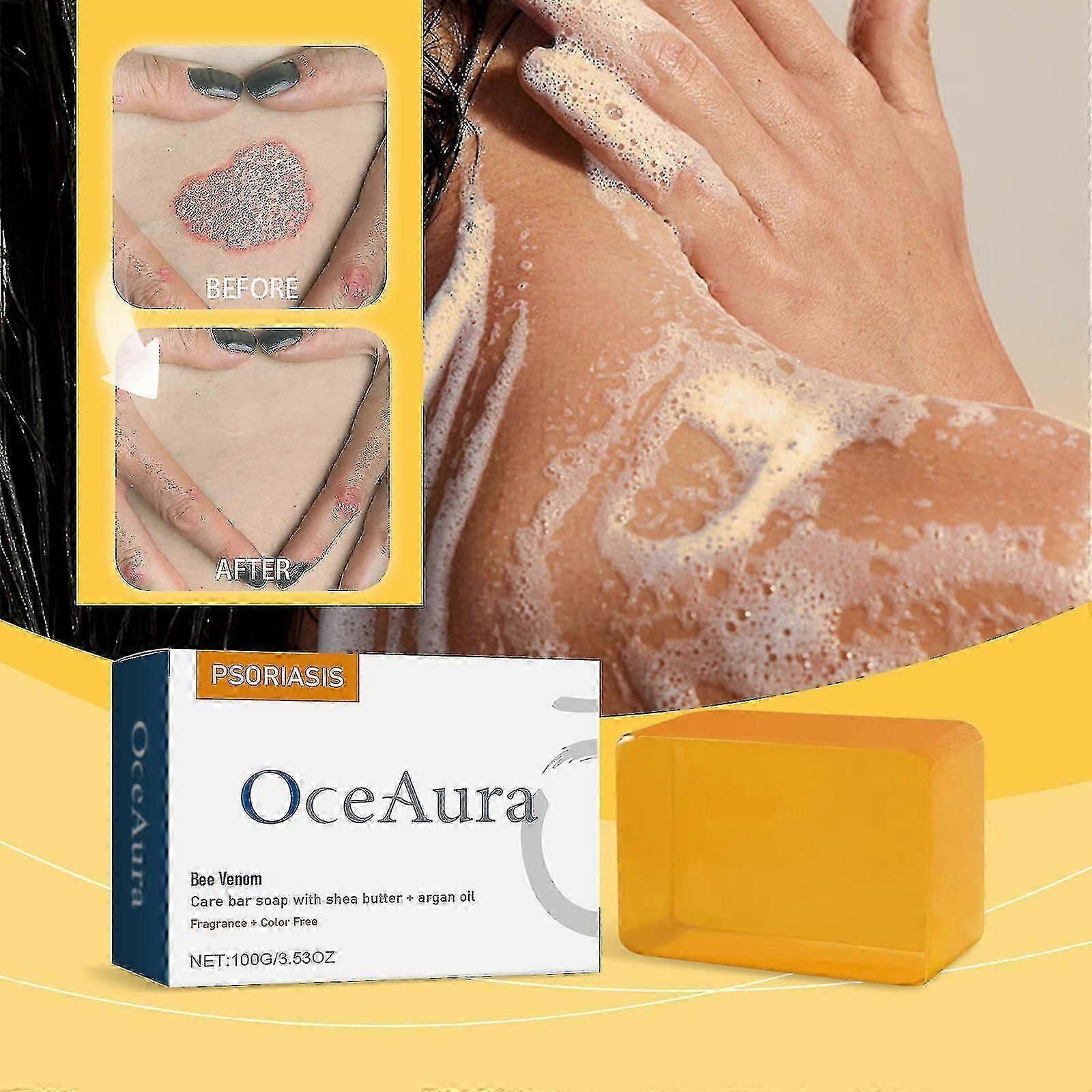 Argan oil psoriasis soap with bee venom